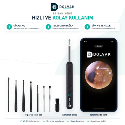 Dolvak Kameralı Kulak Temizleme Cihazı — 1296P HD Wi-Fi
