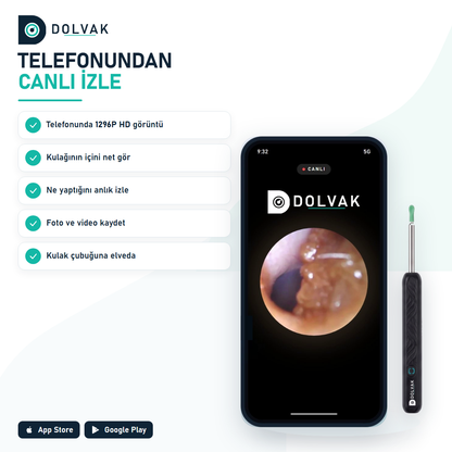 Dolvak Kameralı Kulak Temizleme Cihazı — 1296P HD Wi-Fi